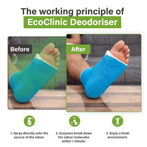 Voor-en-na-afbeelding van een voet in een blauw gipsverband, waarbij EcoClinic Ontgeurder wordt gebruikt om geur te verwijderen.